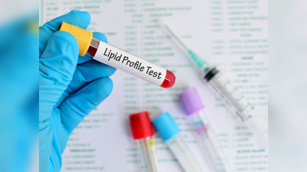 Blood test results.